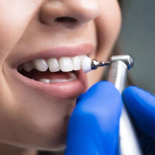Teeth Cleaning in Dombivli