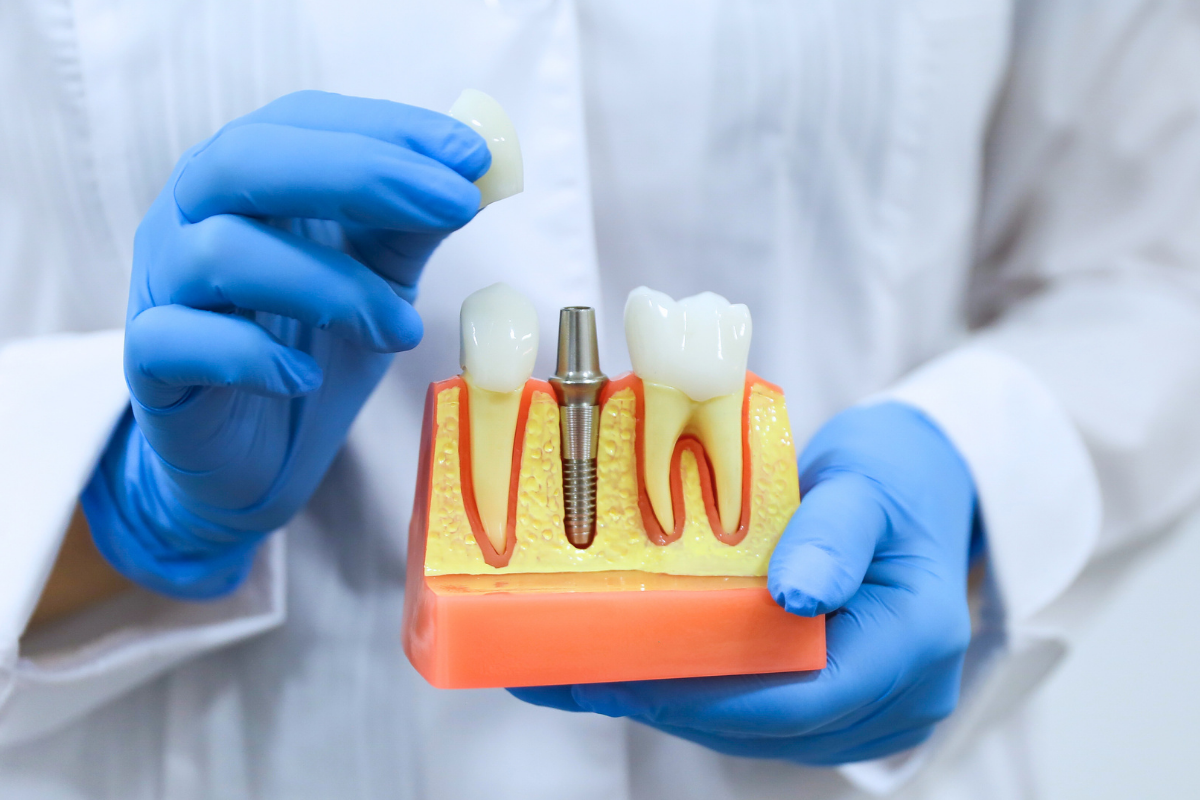 replacing-missing teeth