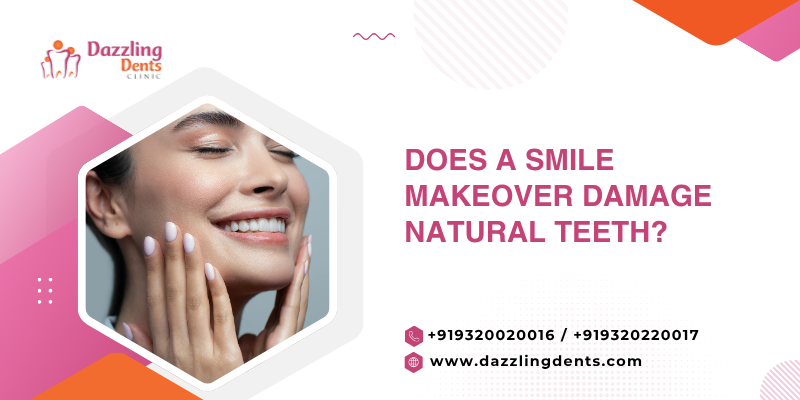 Does a Smile Makeover Damage Natural Teeth?