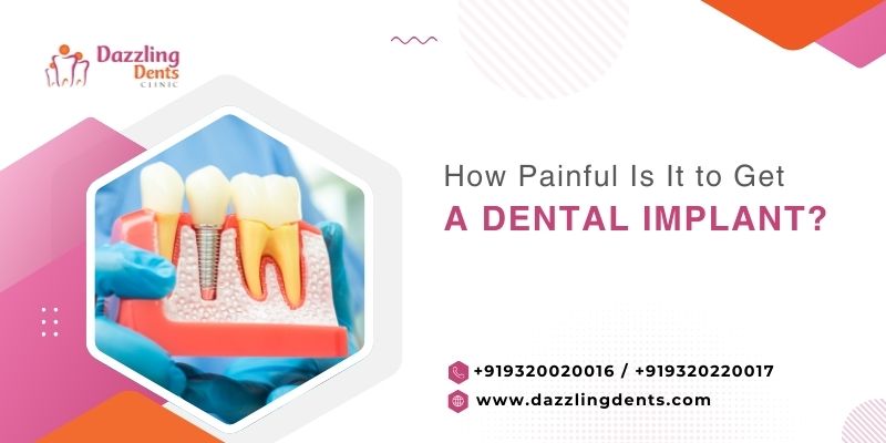 How Painful Is It to Get a Dental Implant?