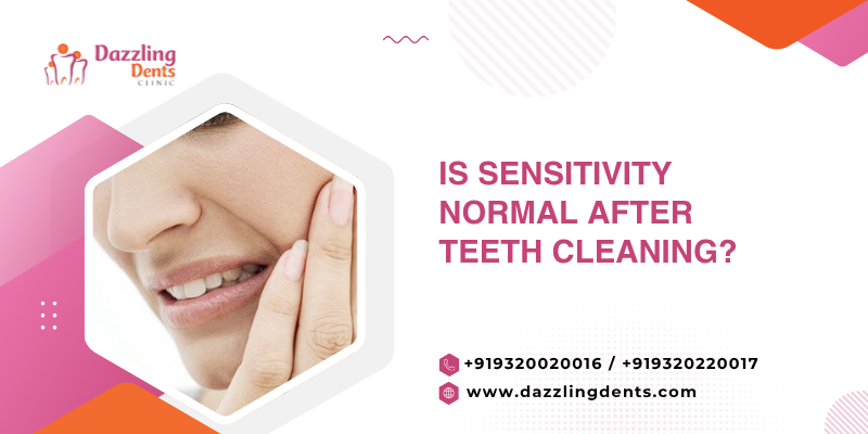 Is Sensitivity Normal After Teeth Cleaning?