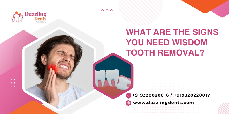 What Are the Signs You Need Wisdom Tooth Removal?