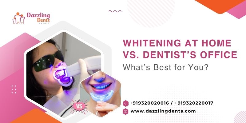 Whitening at Home vs. Dentists Office Whats Best for You?